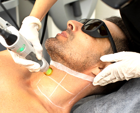 laser hair removal in oak lawn