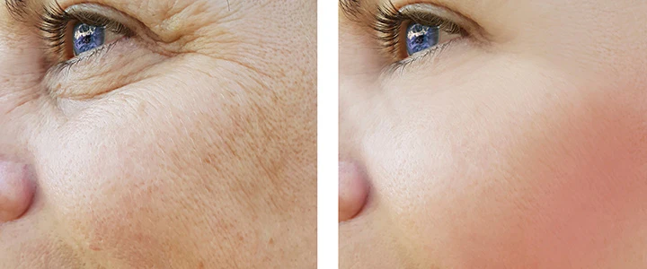 facial rejuvenation in oaklawn
