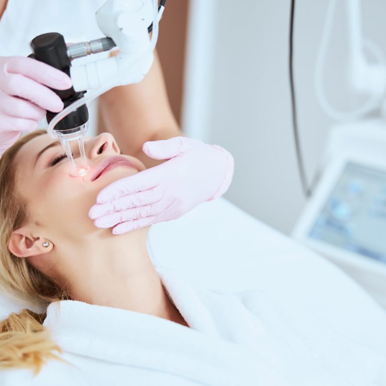 Pleased,Young,Caucasian,Female,Undergoing,The,Fractional,Carbon,Dioxide,Laser